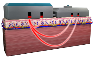 A diagram of a NIRSense patient monitor on top of body tissues showing how its optical sensing techniques work.